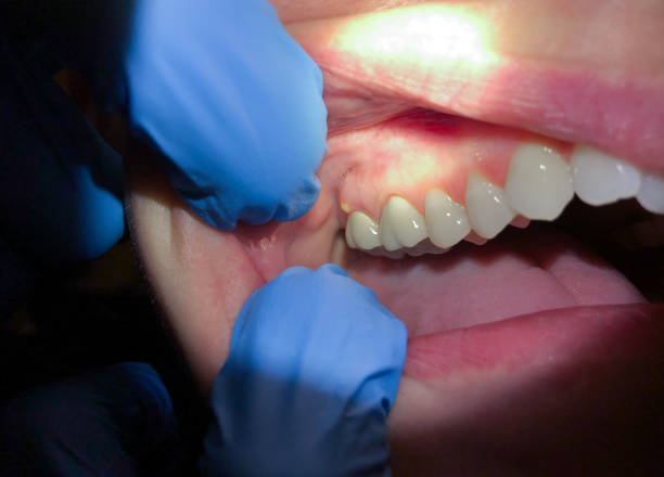Best Emergency Cosmetic Dentistry (e.g., broken veneers) in Augusta, ME